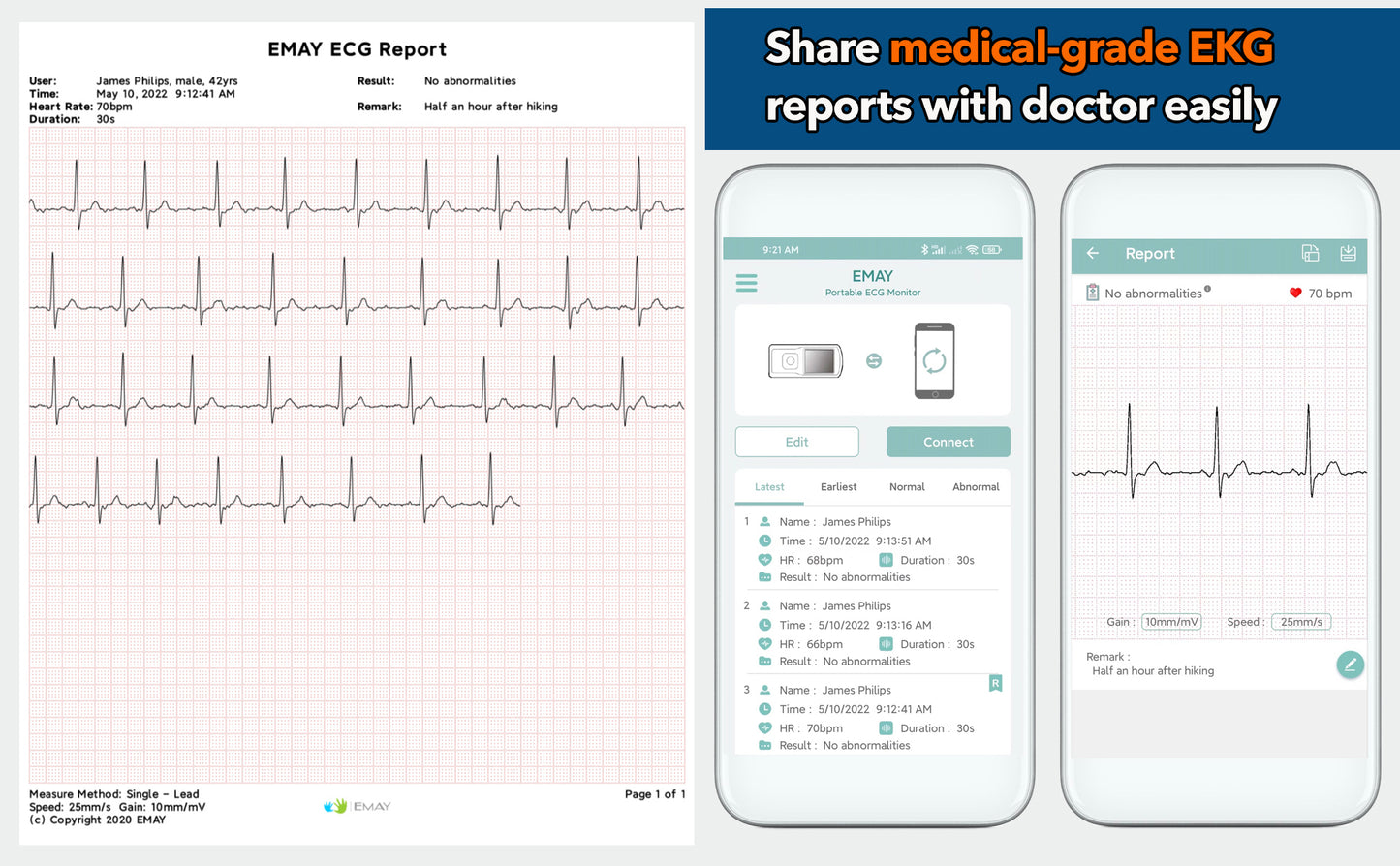 Portable EKG Monitor (Blue)