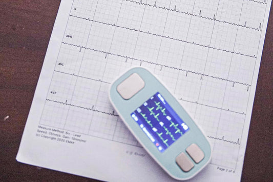 Explanation of 13 symptoms detected by EKG monitors.