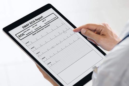 How to read an EKG/ECG Report