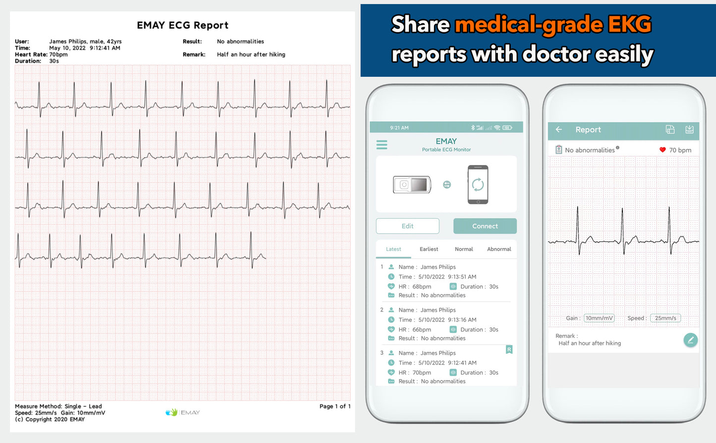 Portable EKG Monitor (Grey)