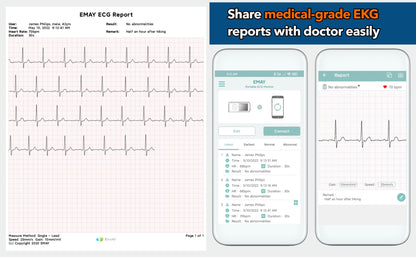 Portable EKG Monitor (Grey)