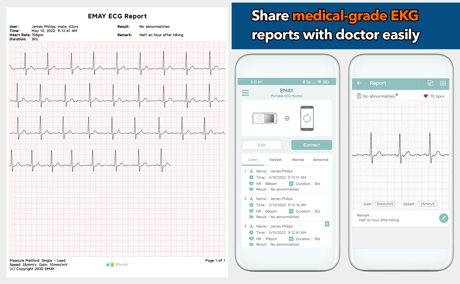 Portable EKG Monitor (Green)