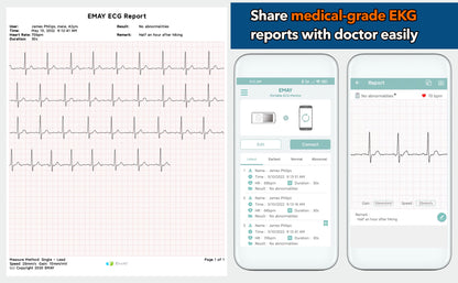 Portable EKG Monitor (Blue)