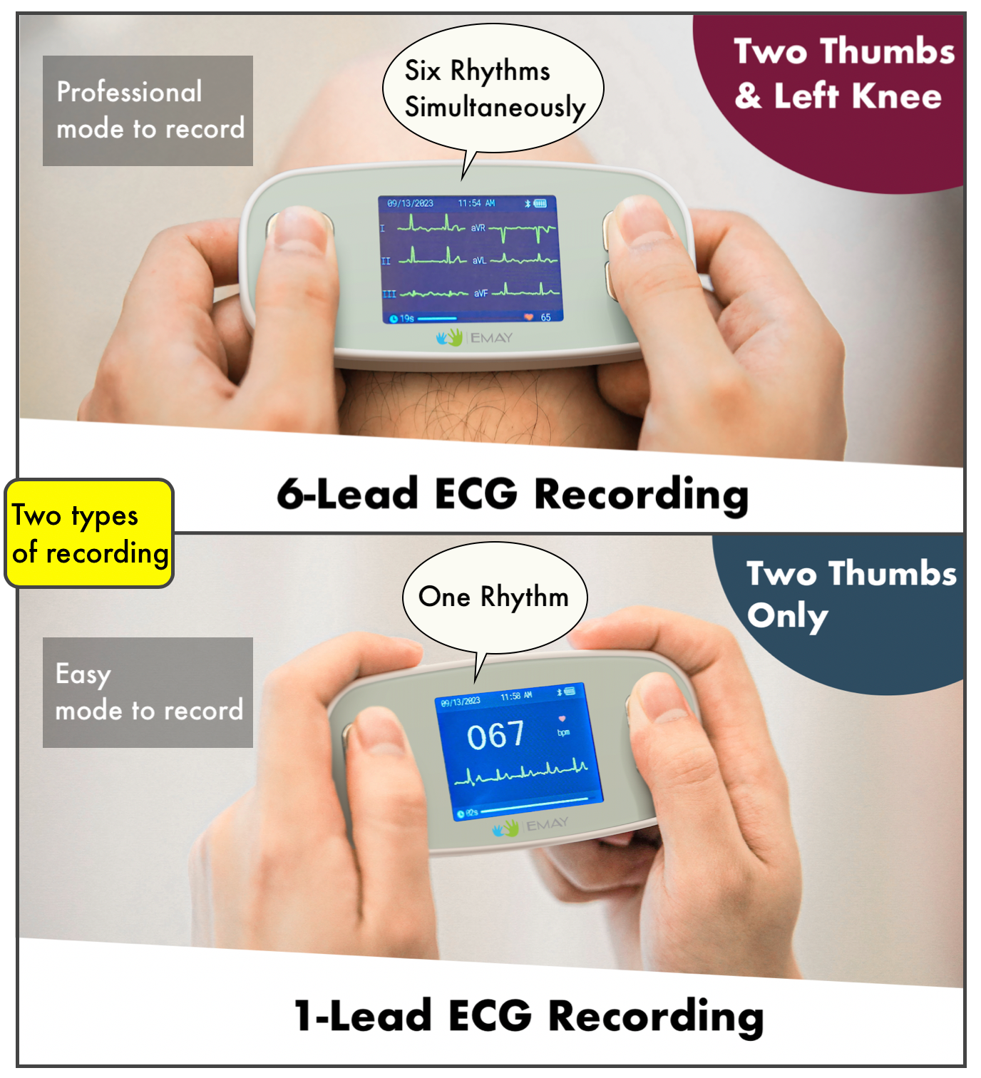 6L Portable EKG Monitor