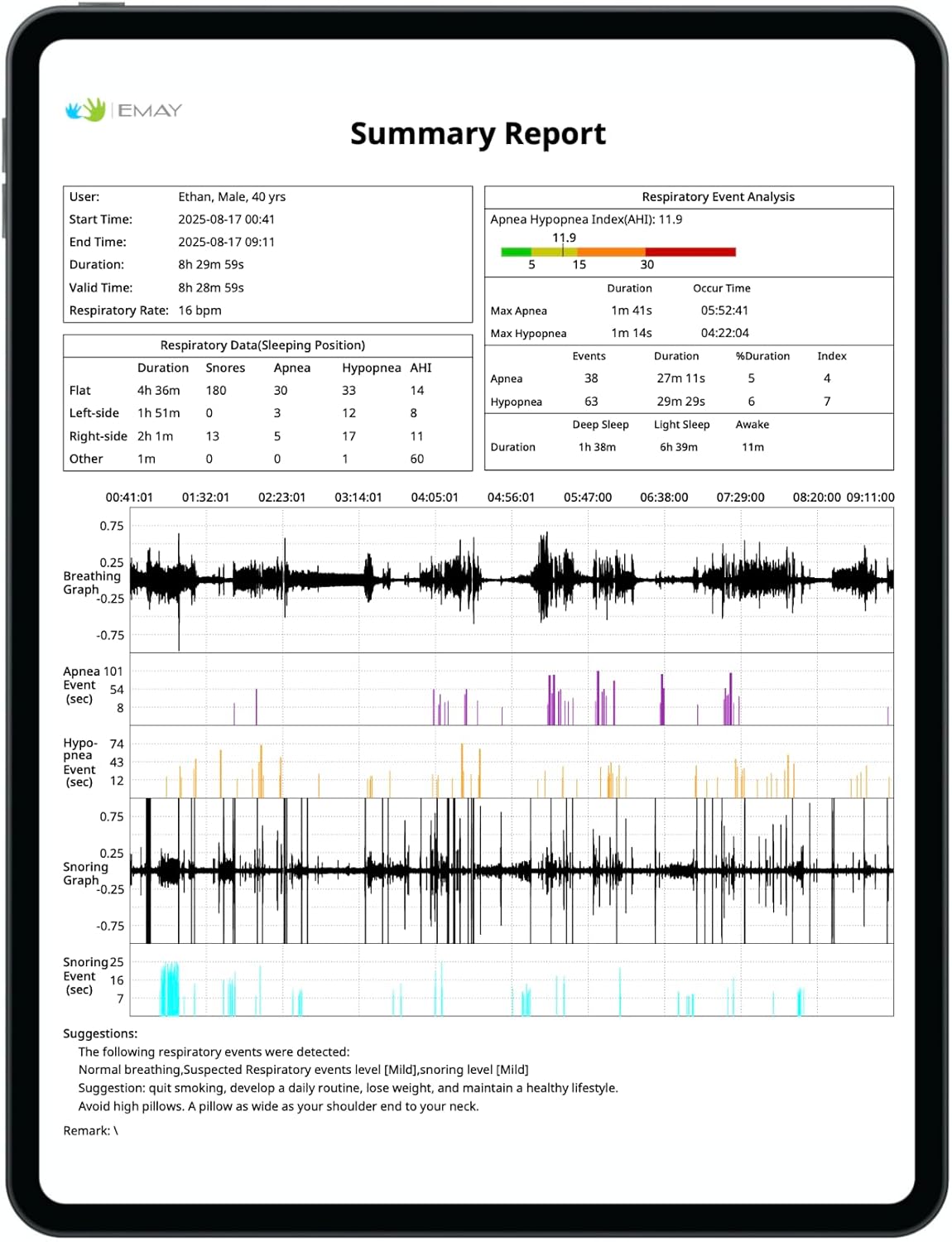 Sleep Breathing Monitor